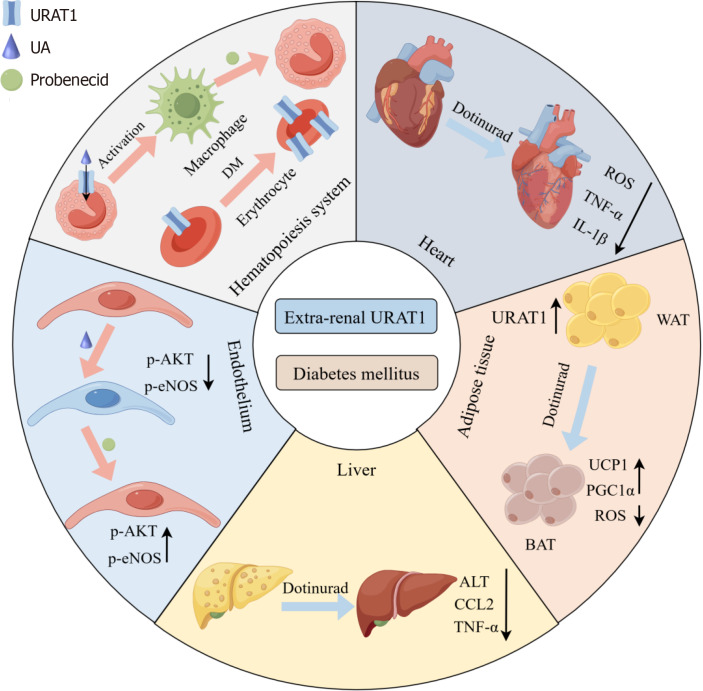 Extra-renal role of urate transporter-1 in diabetes.