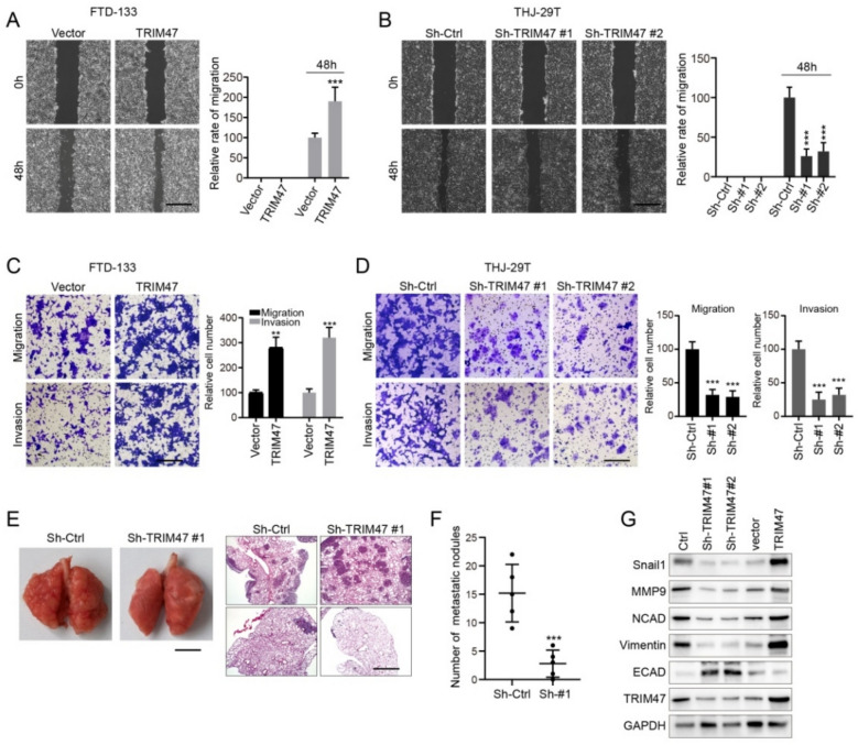 Tripartite motif 47 promotes the development of thyroid carcinoma through ADAR ubiquitination.