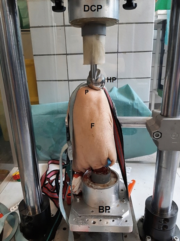 Simulation of realistic patella fractures: an investigation into the mechanism and potential benefit for surgical training.