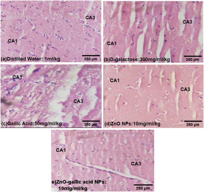 Anxiolytic effect of zinc oxide gallic acid composite nanoparticles following D-galactose administration in rats.