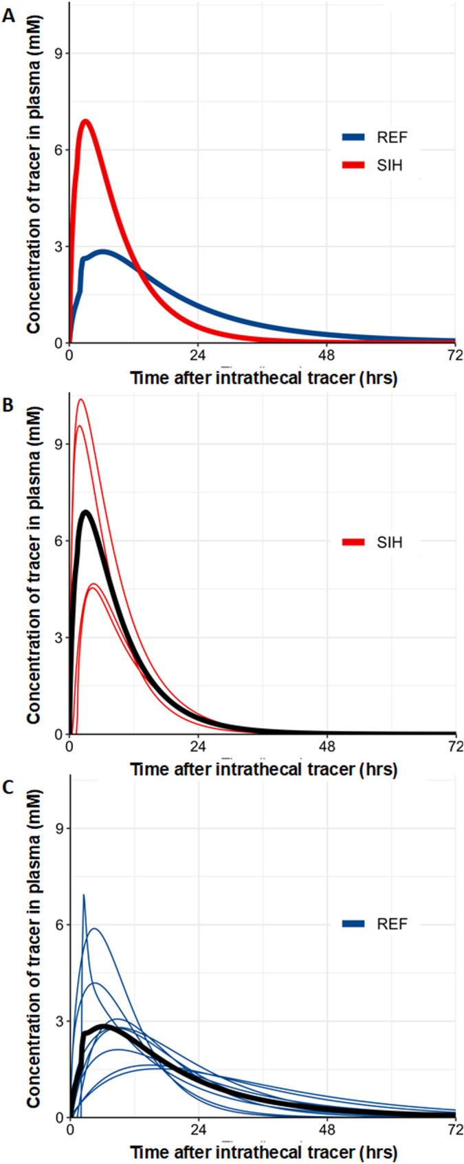 Altered brain fluid dynamics in spontaneous intracranial hypotension.