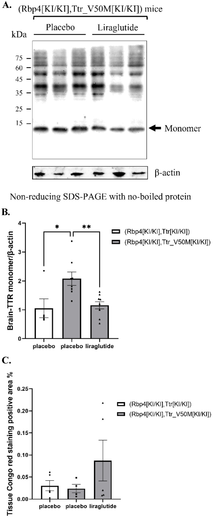 Cardiovascular and brain effects of liraglutide in transthyretin amyloidosis (ATTR) mice models.