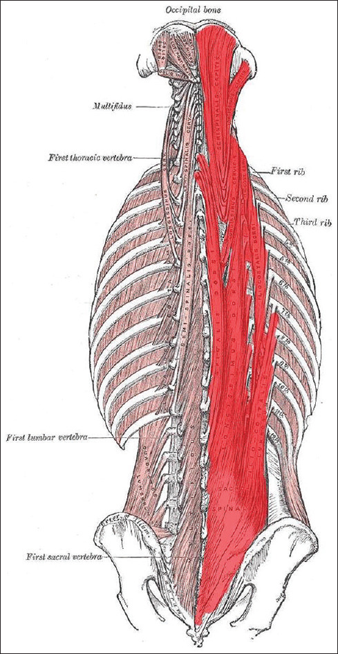 Sacral erector spinae block: A new era for postoperative analgesia-a narrative review.