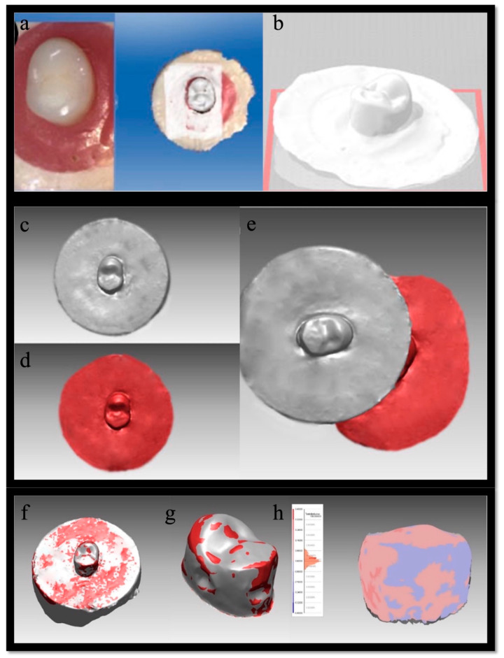 In-Vitro Assessment of Artificial Tooth Material Wear Behavior Using 3D Wear Analysis.