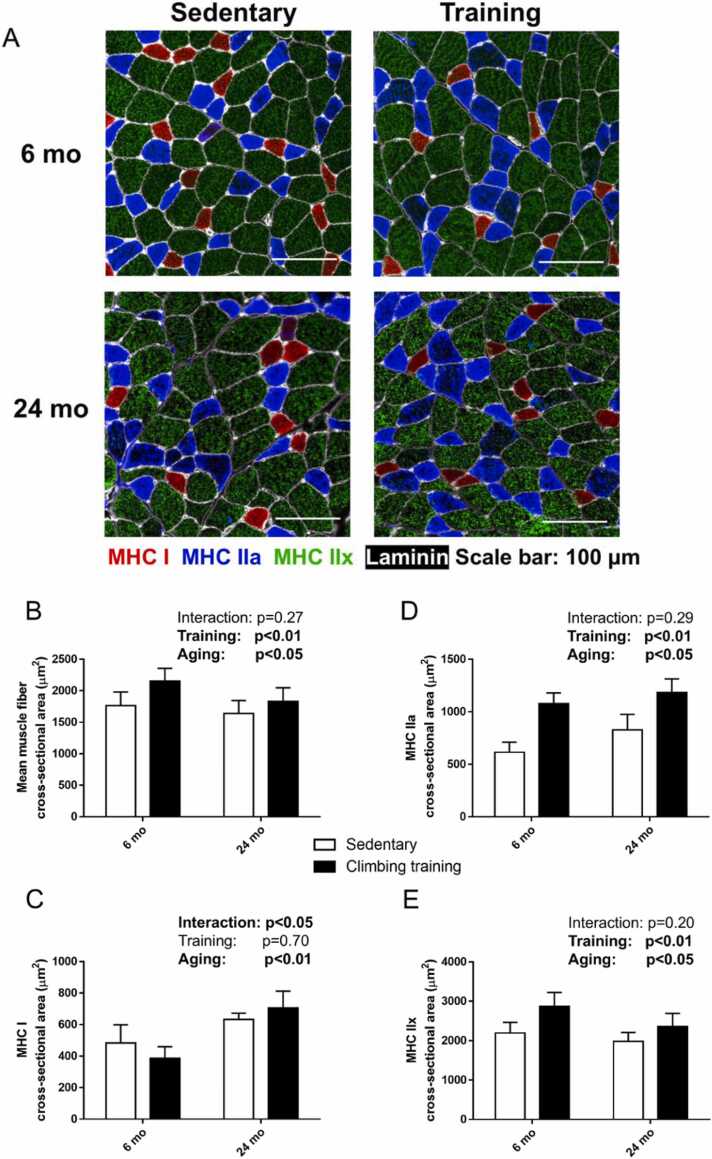 Resistance training-induced dihydrotestosterone is blunted in aging rat skeletal muscle.
