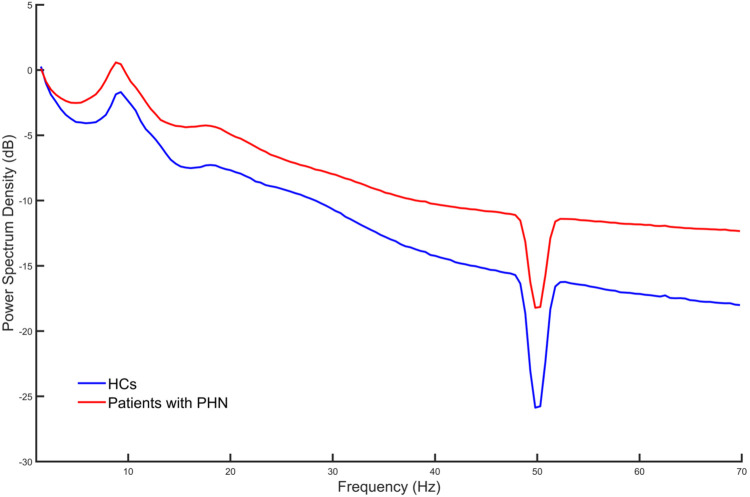 Altered neural oscillation patterns and functional connectivity in postherpetic neuralgia: evidence from resting-state EEG.