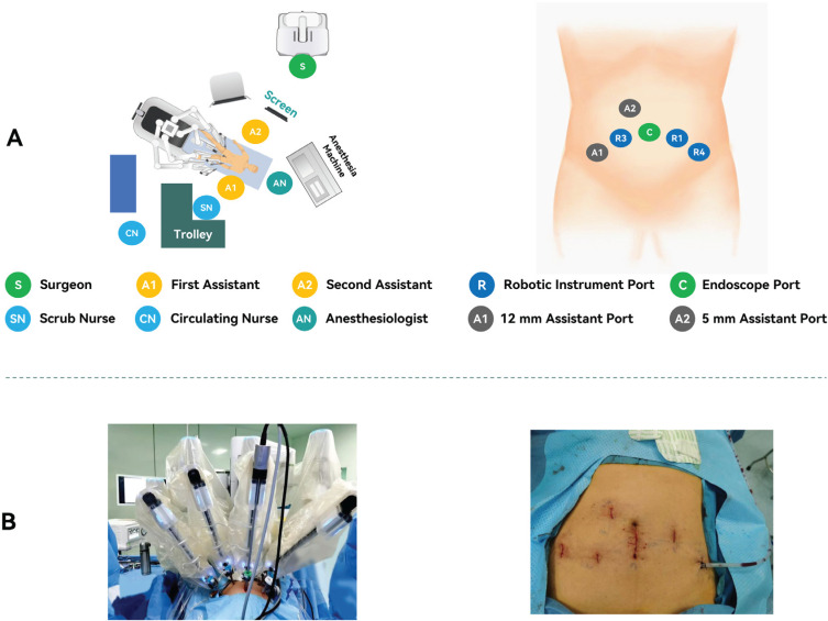 Clinical Outcomes and Cost-effectiveness between the Sentire® and da Vinci® systems in Robot-assisted Radical Prostatectomy.