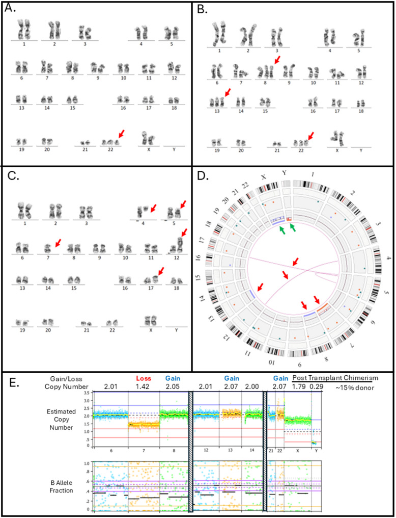 What the VAF? A guide to the interpretation of variant allele fraction, percent mosaicism, and copy number in cancer.
