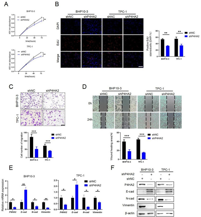 P4HA2 promotes the progression of papillary thyroid cancer by enhancing degradation of IκBα to activate NF-κB signaling pathway.