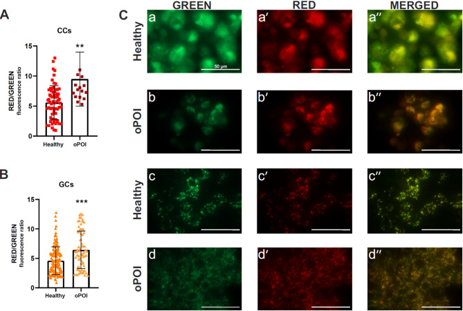 Energy imbalance in oPOI ovarian granulosa cells is linked to reduced glucose bioavailability and metabolism.