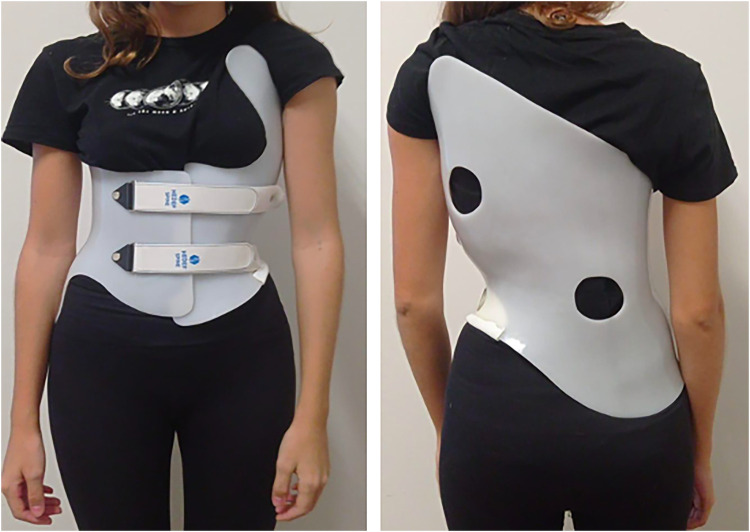Understanding bracing outcomes in adolescents with idiopathic scoliosis: a mixed-methods approach.
