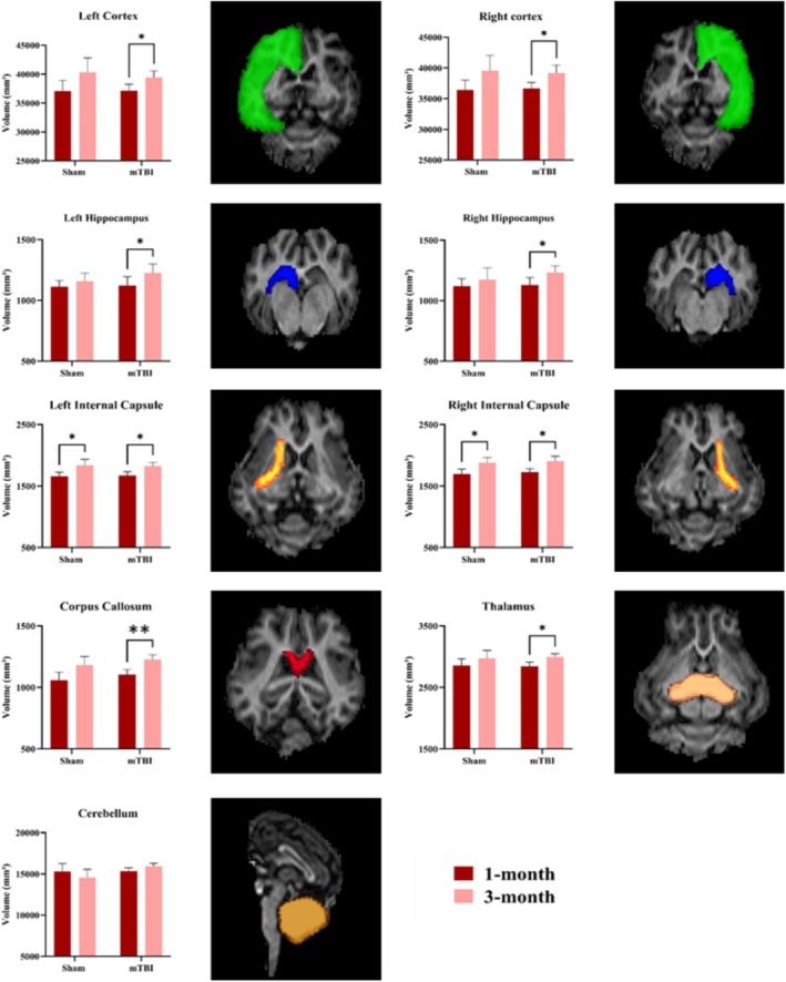 Volumetric and Diffusion Tensor Imaging Abnormalities Are Associated With Behavioral Changes Post-Concussion in a Youth Pig Model of Mild Traumatic Brain Injury.