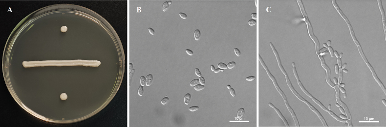 ﻿<i>Yamadazymaakebiae</i> sp. nov. and <i>Y.hainanensis</i> sp. nov. (Debaryomycetaceae, Saccharomycetales) from leaf in China.
