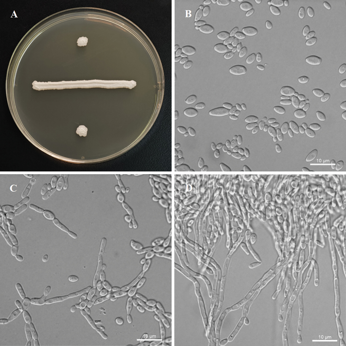 ﻿<i>Yamadazymaakebiae</i> sp. nov. and <i>Y.hainanensis</i> sp. nov. (Debaryomycetaceae, Saccharomycetales) from leaf in China.
