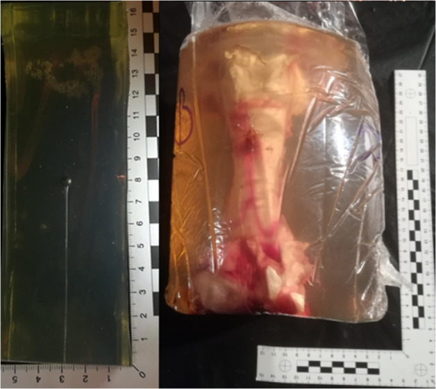 Analysis of gunshot damage to the porcine femur in a human thigh model using 5.5 mm airgun pellet: 3D reconstruction of gunshot injuries.