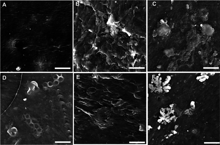 Identification of novel polyethylene-degrading fungi from South African landfill soils: Arthrographis kalrae, Lecanicillium coprophilum, and Didymosphaeria variabile.