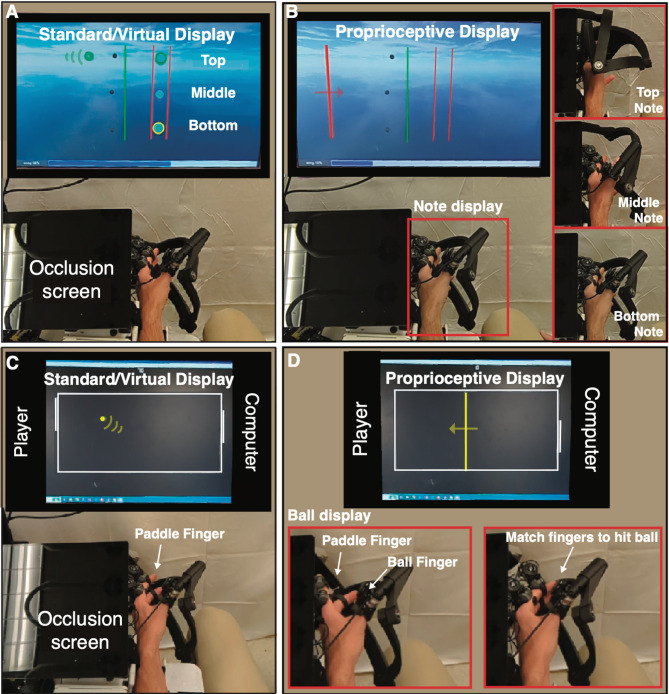 Variants of active assist robotic therapy: feasibility of virtual assistance and proprioceptive training as gauged by their effects on success and motivation during finger movement training after stroke.