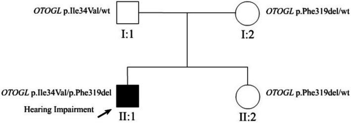 Biallelic Mutations in the Otogelin-Like Gene (OTOGL) Associated With Congenital Non-Syndromic Sensorineural Hearing Loss in a Chinese Family.