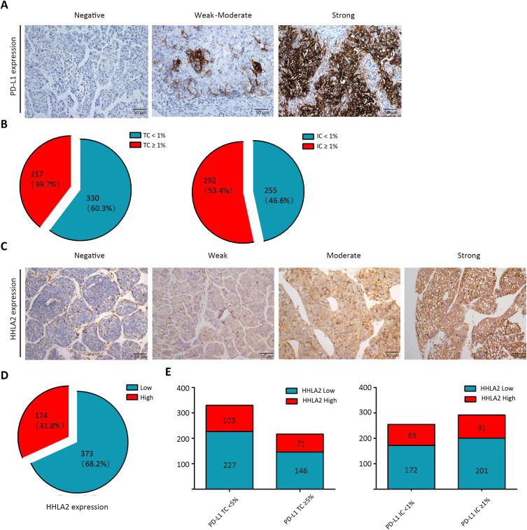 Distinct Roles of HHLA2 and PD-L1 in the Immune Cell and Prognosis of Hepatocellular Carcinoma.