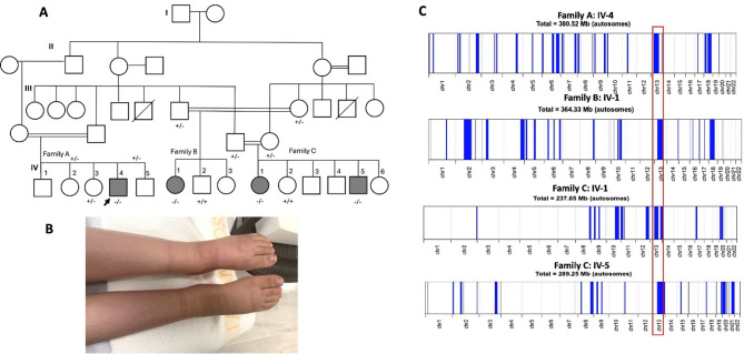 A novel LACC1 variant c.658G>A (p. Asp220Asn) in familial juvenile arthritis: identification and functional analysis.