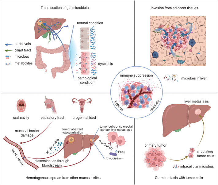 Unveiling the intratumor microbiome in liver cancer: Current insights and prospective applications.