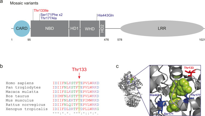 Somatic Mosaic NLRC4 Variants in Autoinflammatory Diseases: Functional Characterization and Correlation of Mosaicism Levels with Disease Age of Onset and Severity.