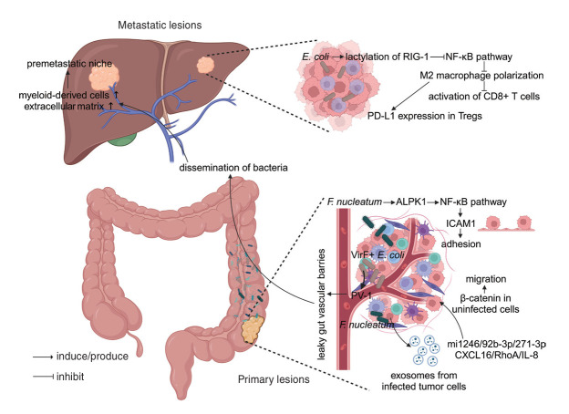 Unveiling the intratumor microbiome in liver cancer: Current insights and prospective applications.