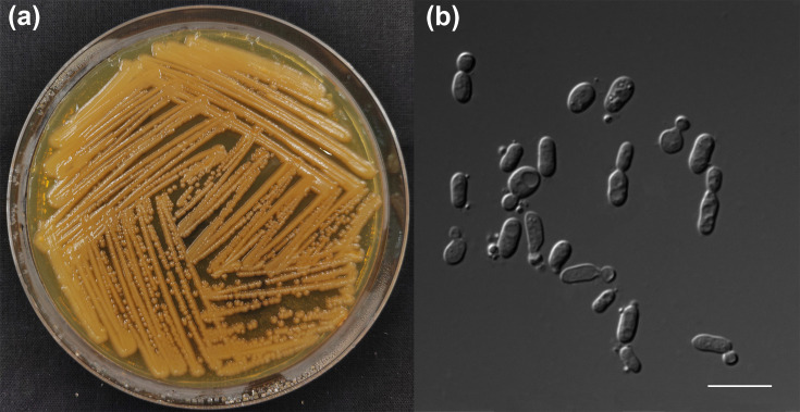 <i>Rhodotorula silvicola</i> sp. nov., a new yeast species from plant-associated substrates and mushroom.