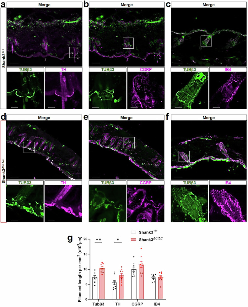 Primary sensory neuron dysfunction underlying mechanical itch hypersensitivity in a Shank3 mouse model of autism.