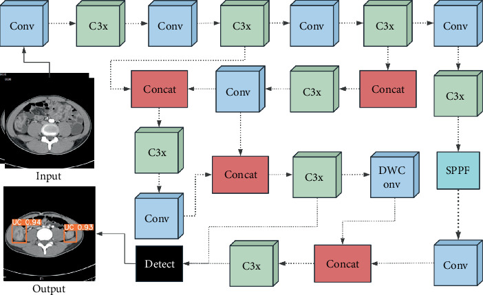 Use of Modified YOLOv5 Algorithm in the Differential Diagnosis of Colonic Crohn's Disease and Ulcerative Colitis on CTE Images.