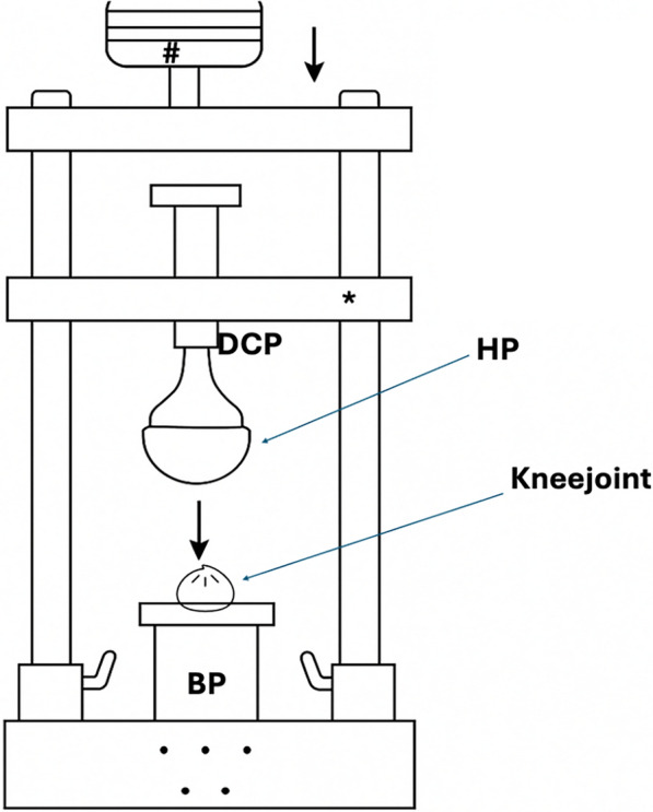 Simulation of realistic patella fractures: an investigation into the mechanism and potential benefit for surgical training.