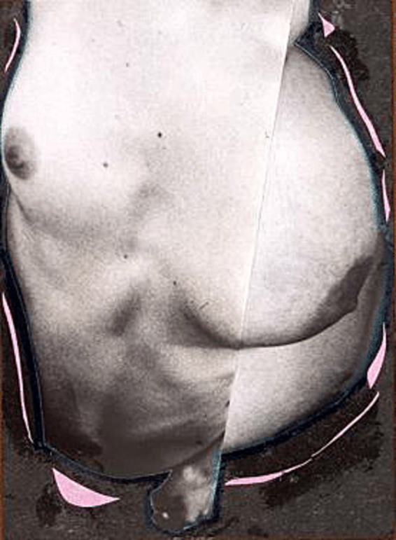 Freak to queer bodies: affirming the grotesque in contemporary art.