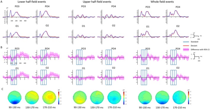 Shaping the Visual Mismatch Response: The Influence of Exogenous Components and Stimulus Placement.