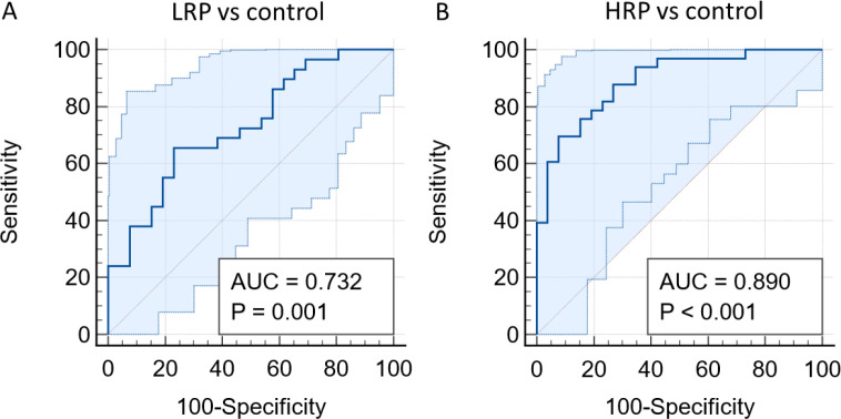 Combined Methylation Analysis of SDC2 and TFPI2 in Plasma: A Noninvasive Liquid Biopsy Approach for Early Detection of Colorectal Polyp.