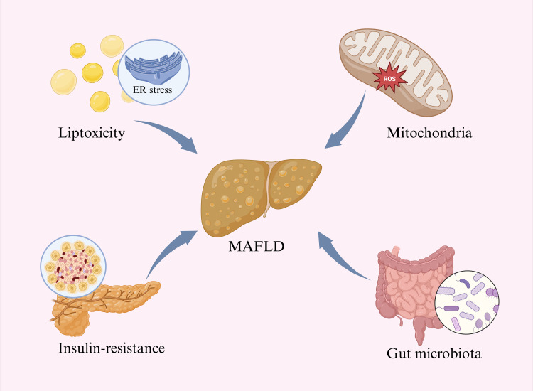 Immune Microenvironment on the Molecular Mechanisms and Therapeutic Targets of MAFLD.
