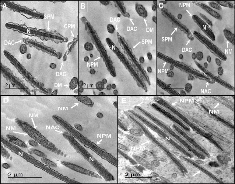 Beneficial effects of carvacrol loaded phytosomes on enhancing cryotolerance of Buffalo semen following cryopreservation.