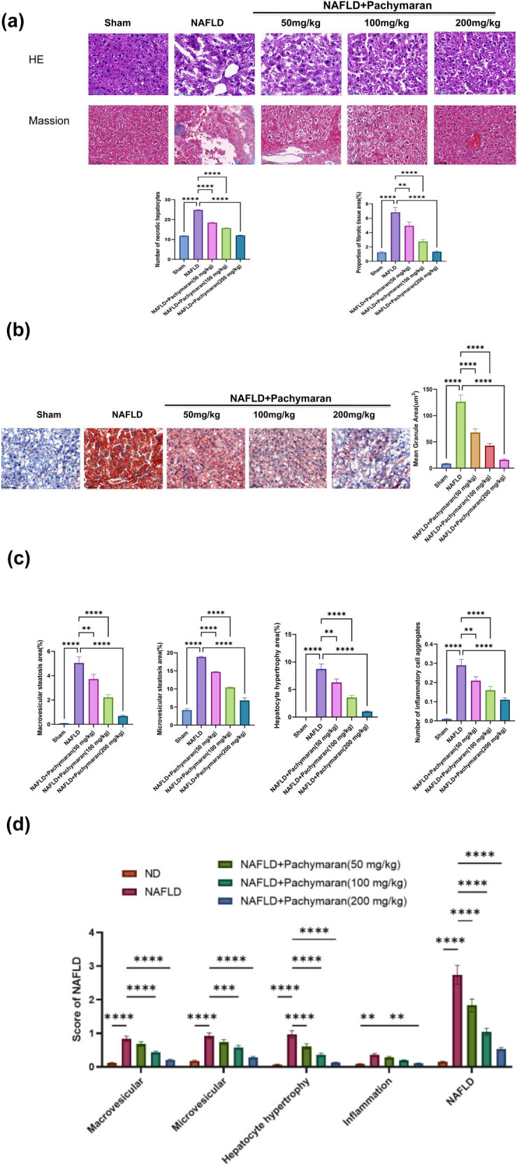 Pachymaran alleviates fat accumulation, hepatocyte degeneration, and injury in mice with nonalcoholic fatty liver disease.