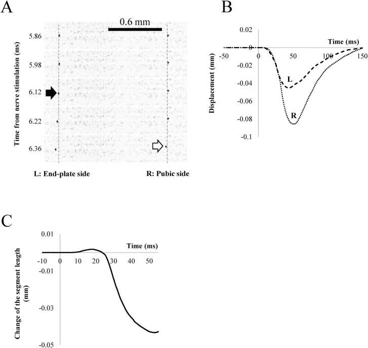 Extending wave propagation along muscle fibers originates from early local contraction at the end-plate region.