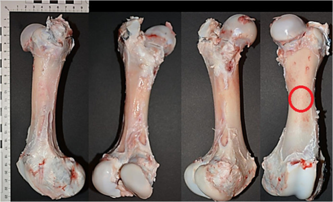 Analysis of gunshot damage to the porcine femur in a human thigh model using 5.5 mm airgun pellet: 3D reconstruction of gunshot injuries.
