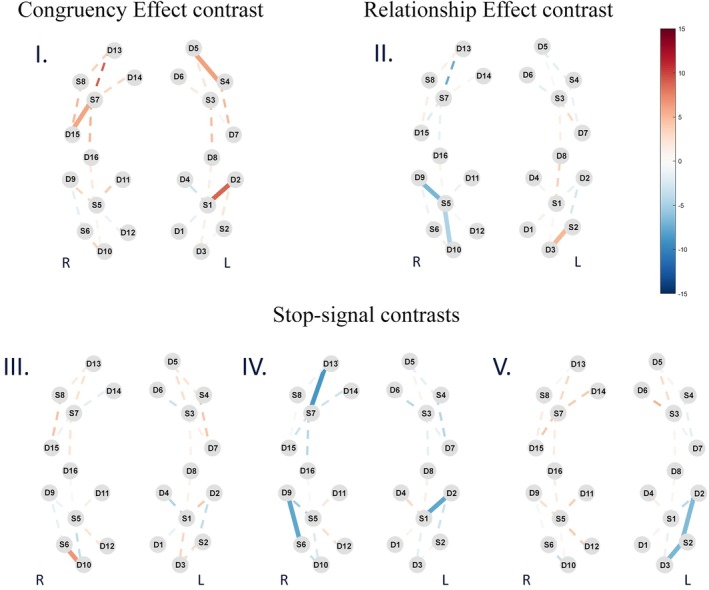 Frontal and Parietal Activities Associated With Different Inhibitory Processes in a Stroop-Matching/Stop-Signal Task: A Channel-Wise fNIRS Study.