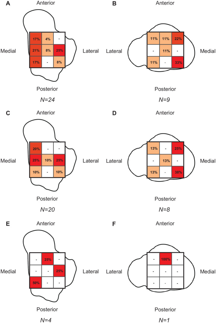 The Prevalence, Size, and Anatomic Location of Cartilage and Osteochondral Lesions in Athletes With an Acute Ligamentous Ankle Injury.