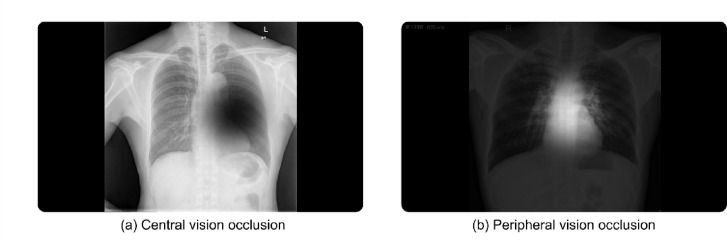 Improving lesion detection skills in medical imaging education through enhanced peripheral visual perception.