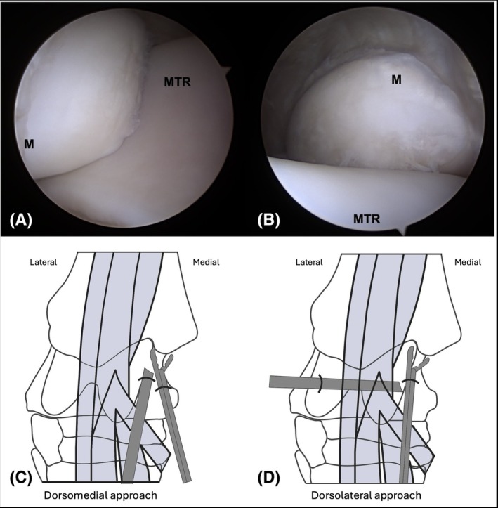 Comparison of a dorsolateral approach and a dorsomedial approach to access the medial malleolus of the distal tibia in horses.