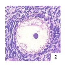 Quantification of polyoocyte follicles (POFs) in domestic cats.