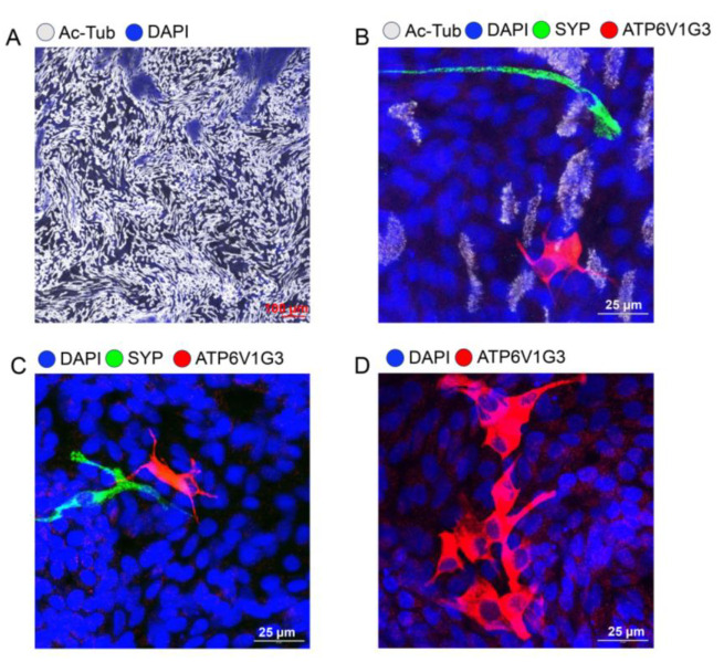Isolation and Culture of Ferret Airway Stem Cells.