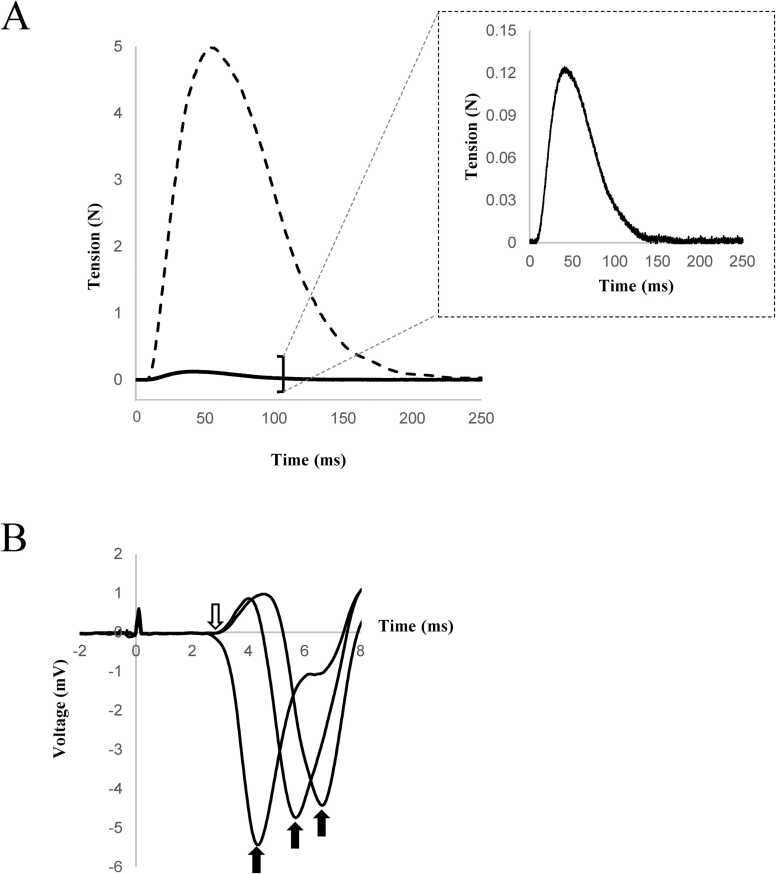 Extending wave propagation along muscle fibers originates from early local contraction at the end-plate region.