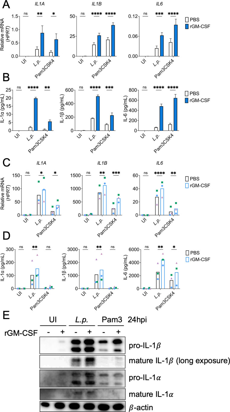 GM-CSF engages multiple signaling pathways to enhance pro-inflammatory cytokine responses in human monocytes during <i>Legionella</i> infection.