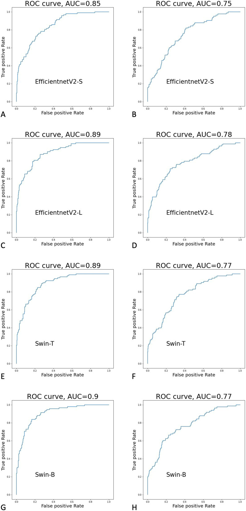 Automatic Real-Time Detection and Diagnosis of Liver Tumor with Ultrasound.