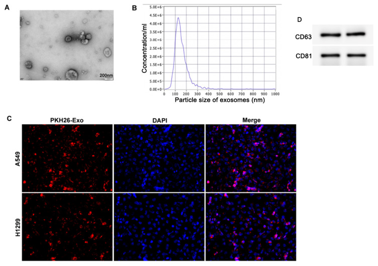 Ginseng-Derived Exosomes Attenuate Immune Evasion in NSCLC via PD-L1 Modulation.