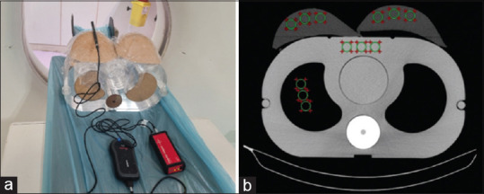 Balancing Radiation Dose Reduction and Image Quality in Chest Computed Tomography using Silicon Rubber-barium Sulfate Composite Shield.